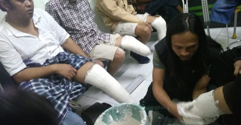 Wujudkan Kaki Palsu untuk Para Penyandang Disabilitas 